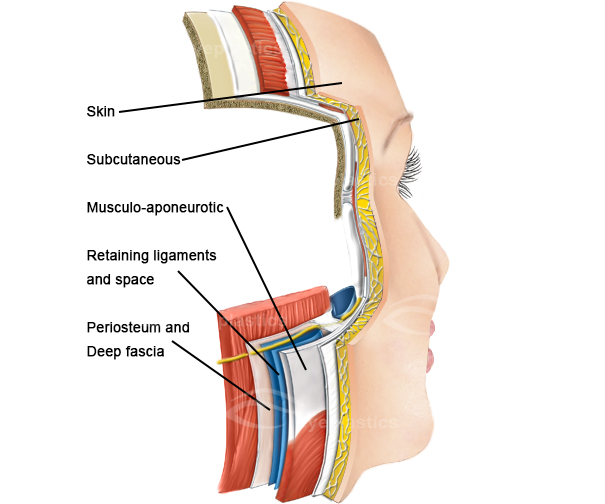 anatomy of face facelift surgery muscles